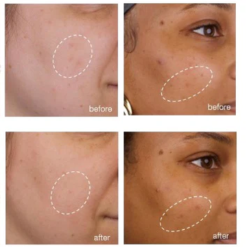Seebz Intima Glow Serum | Multi-Area Whitening with Vitamin C, Alpha Arbutin & Kojic Acid | Hydrates, Fades Dark Spots & Brightens Hyperpigmentation