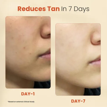 Renee Everyday Face Bright Serum in Cream | Fades Dark Spots, Brightens & Hydrates for All Skin Types