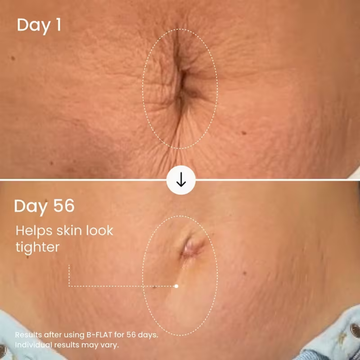 Expressions Wellness Cryo Thermo Firming Gold Gel – Infused with 24K Gold – Firms, Tightens & Transforms Skin – Reduces Stretch Marks, Wrinkles & Cellulite – For Belly, Arms, Thighs & Body Contouring