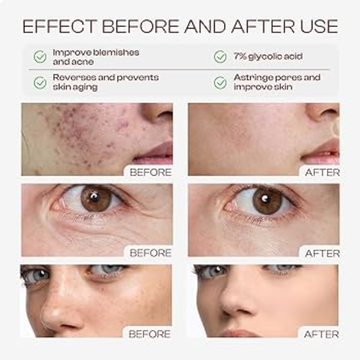 Minimalist Glycolic Acid 08% Exfoliating Liquid – Exfoliate, Smooth & Glow – 8% Glycolic Acid in Free Acid Form + Bamboo Water – Fades Pigmentation, Evens Skin Tone & Texture – For Face, Body & Scalp