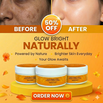 Glow Boost & Anti-Pigmentation Lotion | Niacinamide + Vitamin E + Hyaluronic Acid | Brightening, Hydrating & Dark Spot Corrector