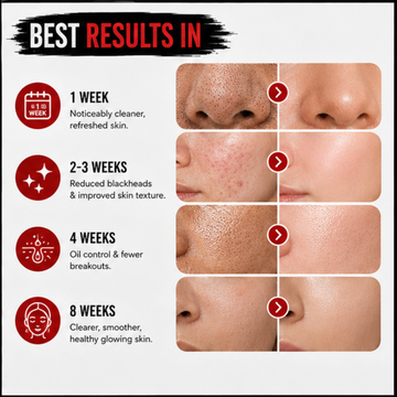 SL Basics Charcoal & Sea Salt Cleansing Scrub with Free SL BB - Buy 1 Get 1 FREE – Deep Exfoliation, Oil Control & Pore Refining – Removes Dirt, Oil & Impurities – Unclogs Pores & Purifies Skin – FREE SL BB Block OAK Included